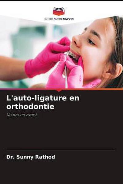 L’auto-ligature en orthodontie