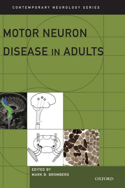 Motor Neuron Disease in Adults