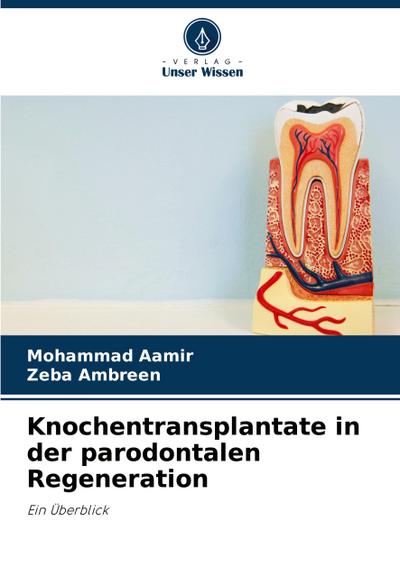 Knochentransplantate in der parodontalen Regeneration