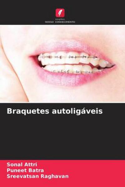 Braquetes autoligáveis