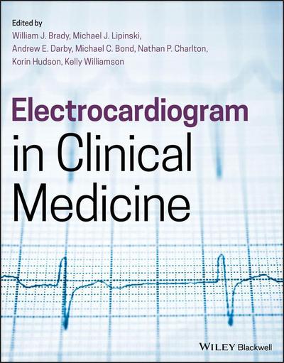 Electrocardiogram in Clinical Medicine