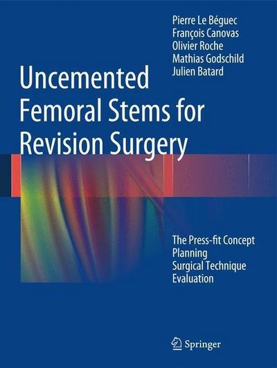 Uncemented Femoral Stems for Revision Surgery