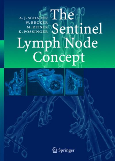 The Sentinel Lymph Node Concept