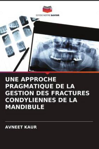UNE APPROCHE PRAGMATIQUE DE LA GESTION DES FRACTURES CONDYLIENNES DE LA MANDIBULE
