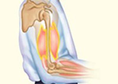 Effect of Load on SMT (Free & After Load)