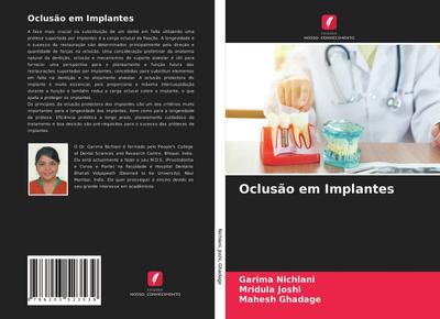 Oclusão em Implantes