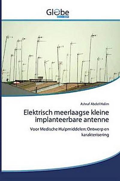 Elektrisch meerlaagse kleine implanteerbare antenne