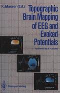Topographic Brain Mapping of EEG and Evoked Potentials