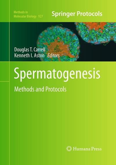 Spermatogenesis