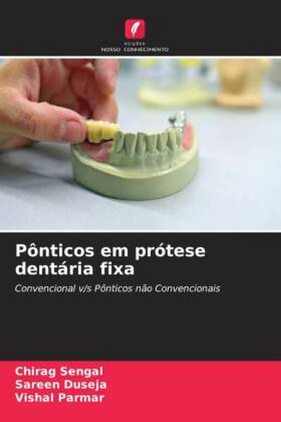 Pônticos em prótese dentária fixa