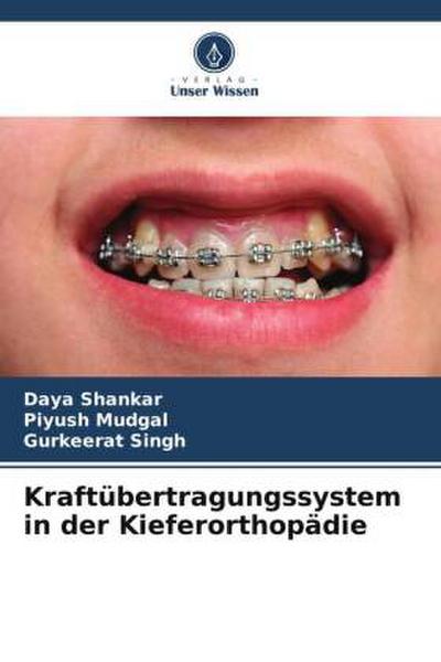 Kraftübertragungssystem in der Kieferorthopädie