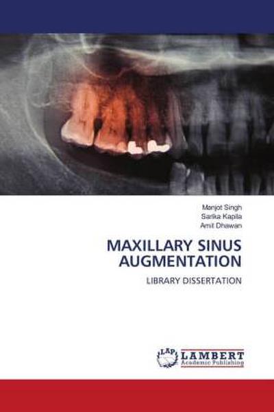 MAXILLARY SINUS AUGMENTATION