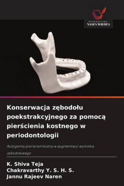 Konserwacja z¿bodo¿u poekstrakcyjnego za pomoc¿ pier¿cienia kostnego w periodontologii