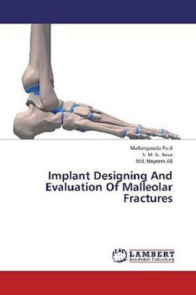 Implant Designing And Evaluation Of Malleolar Fractures
