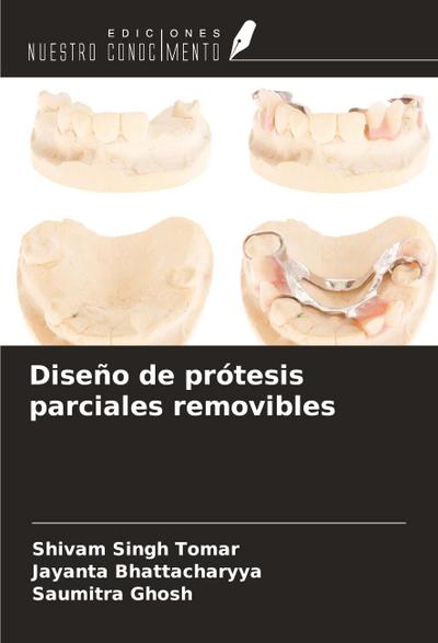 Diseño de prótesis parciales removibles