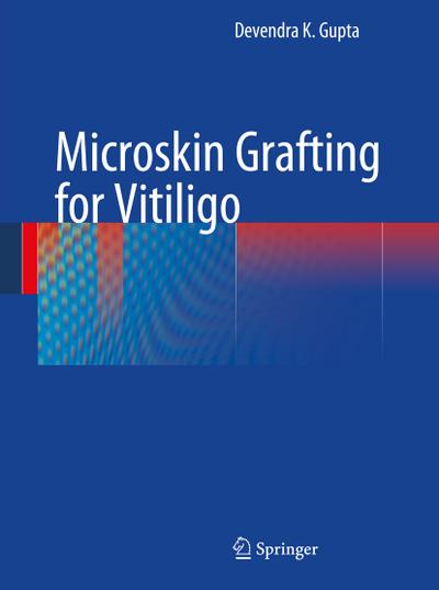 Microskin Grafting for Vitiligo
