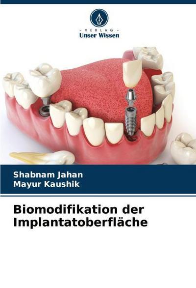 Biomodifikation der Implantatoberfläche