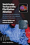 Ventricular Tachycardia / Fibrillation Ablation
