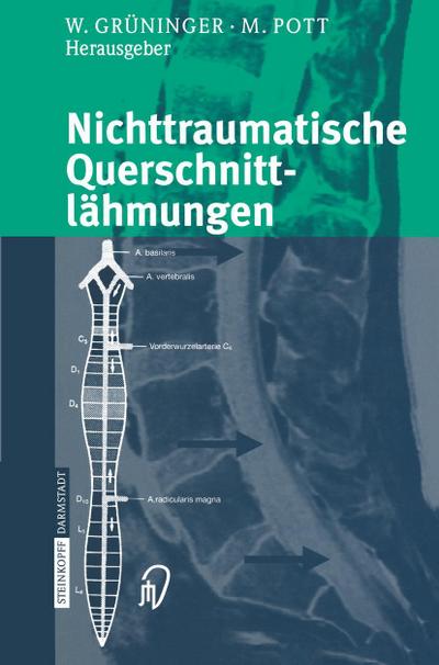 Nichttraumatische Querschnittlähmungen