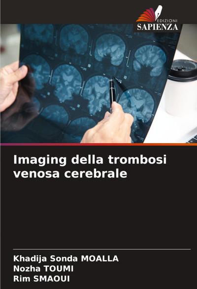 Imaging della trombosi venosa cerebrale