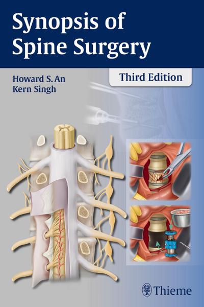 Synopsis of Spine Surgery