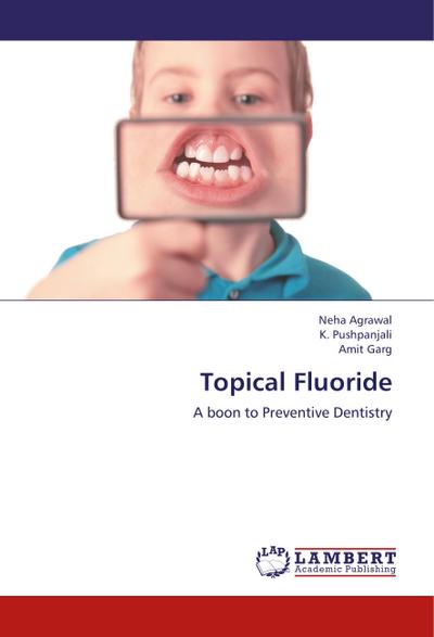 Topical Fluoride