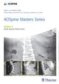 AOSpine Masters Series, Volume 4: Adult Spinal Deformities