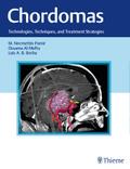 Chordomas