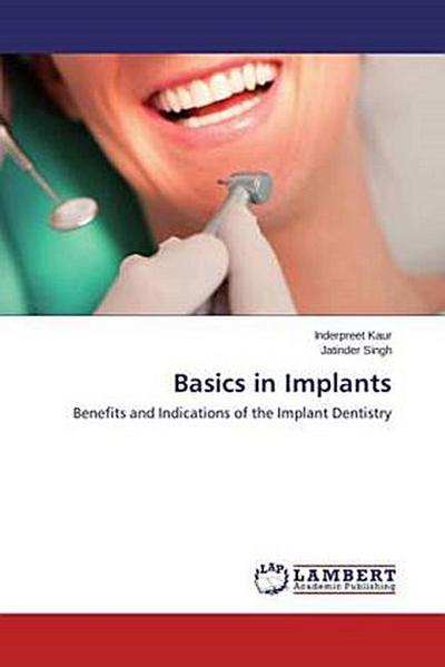 Basics in Implants