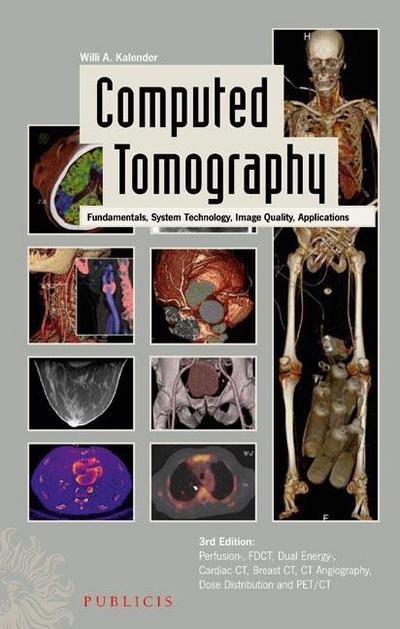 Computed Tomography, w. CD-ROM