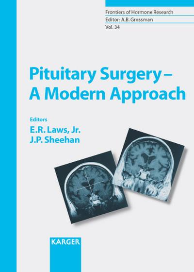 Pituitary Surgery - A Modern Approach