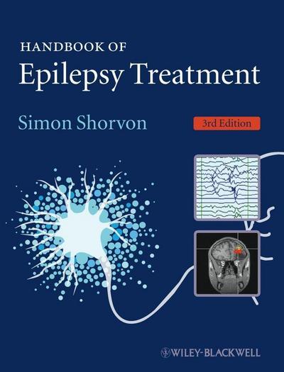 Handbook of Epilepsy Treatment