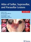 Atlas of Sellar, Suprasellar, and Parasellar Lesions