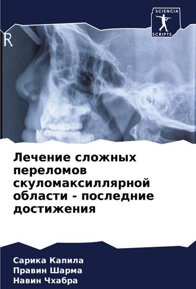Lechenie slozhnyh perelomow skulomaxillqrnoj oblasti - poslednie dostizheniq
