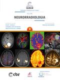 Coleção CBR Volume 8 - Neurorradiologia