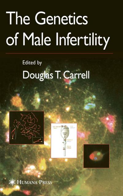 The Genetics of Male Infertility