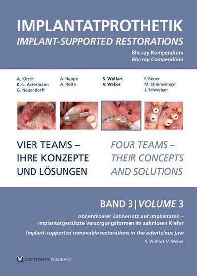Implantatprothetik. Blu-Ray, Band 3