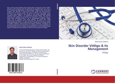 Skin Disorder Vitiligo & Its Management