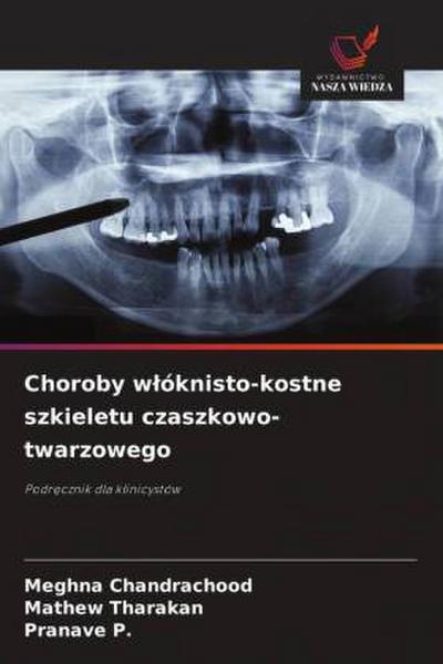 Choroby w¿óknisto-kostne szkieletu czaszkowo-twarzowego