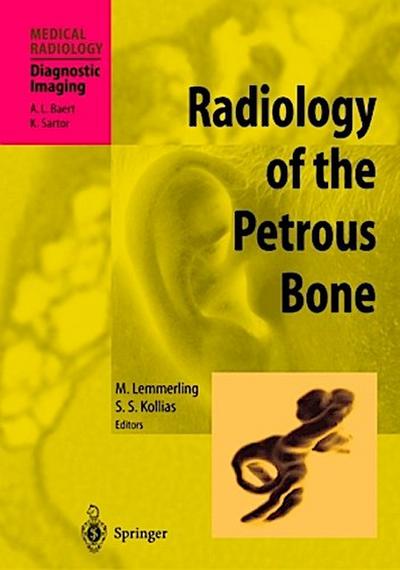 Radiology of the Petrous Bone