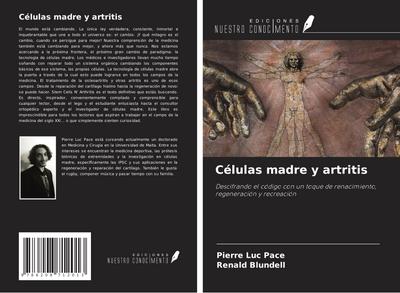 Células madre y artritis