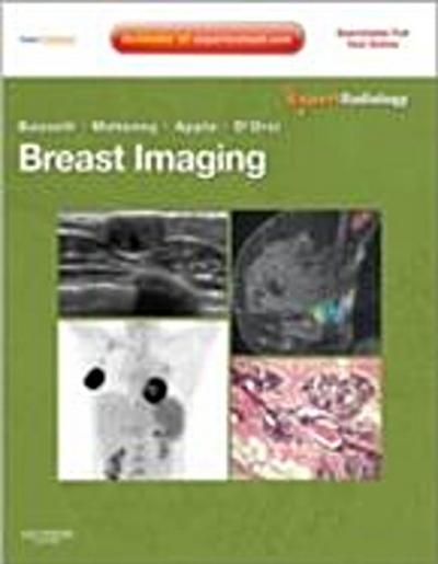 Breast Imaging Expert Radiology Series E-Book