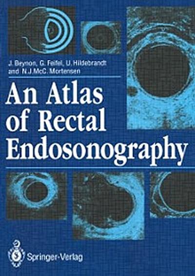 Atlas of Rectal Endosonography