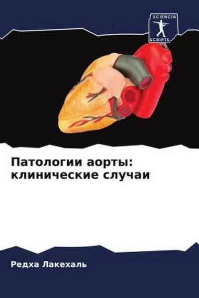 Patologii aorty: klinicheskie sluchai