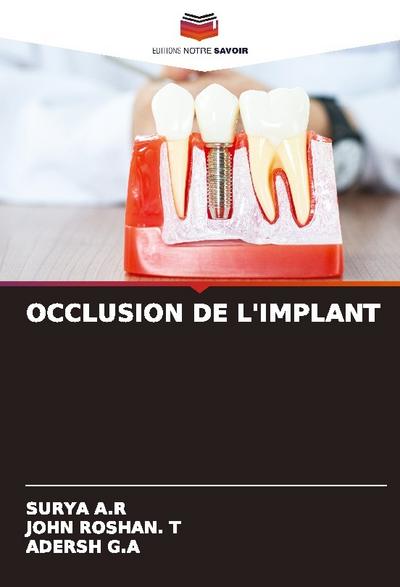 OCCLUSION DE L’IMPLANT