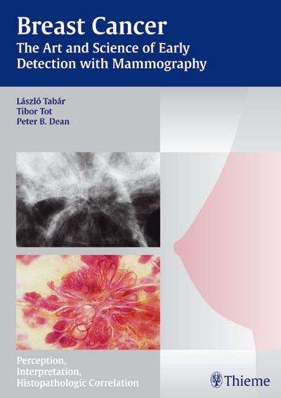Mammography - The Art and Science of Early Detection