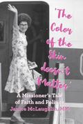 McLaughlin: ’The Color of the Skin doesn’t Matter’