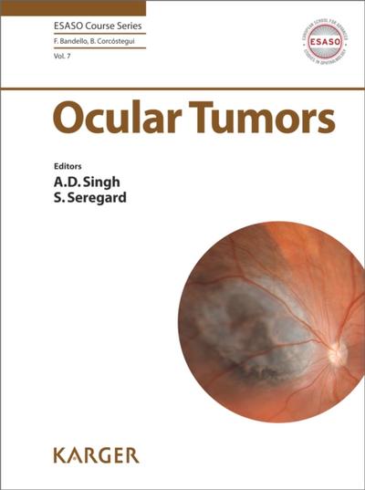 Ocular Tumors