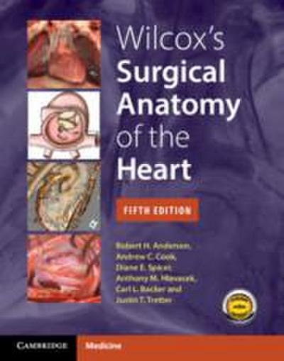 Wilcox’s Surgical Anatomy of the Heart