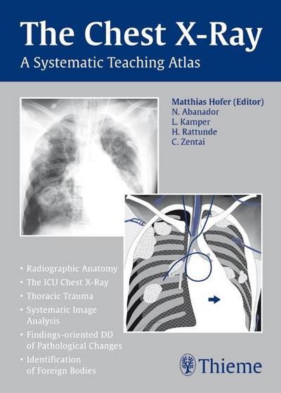 Chest X-ray Trainer